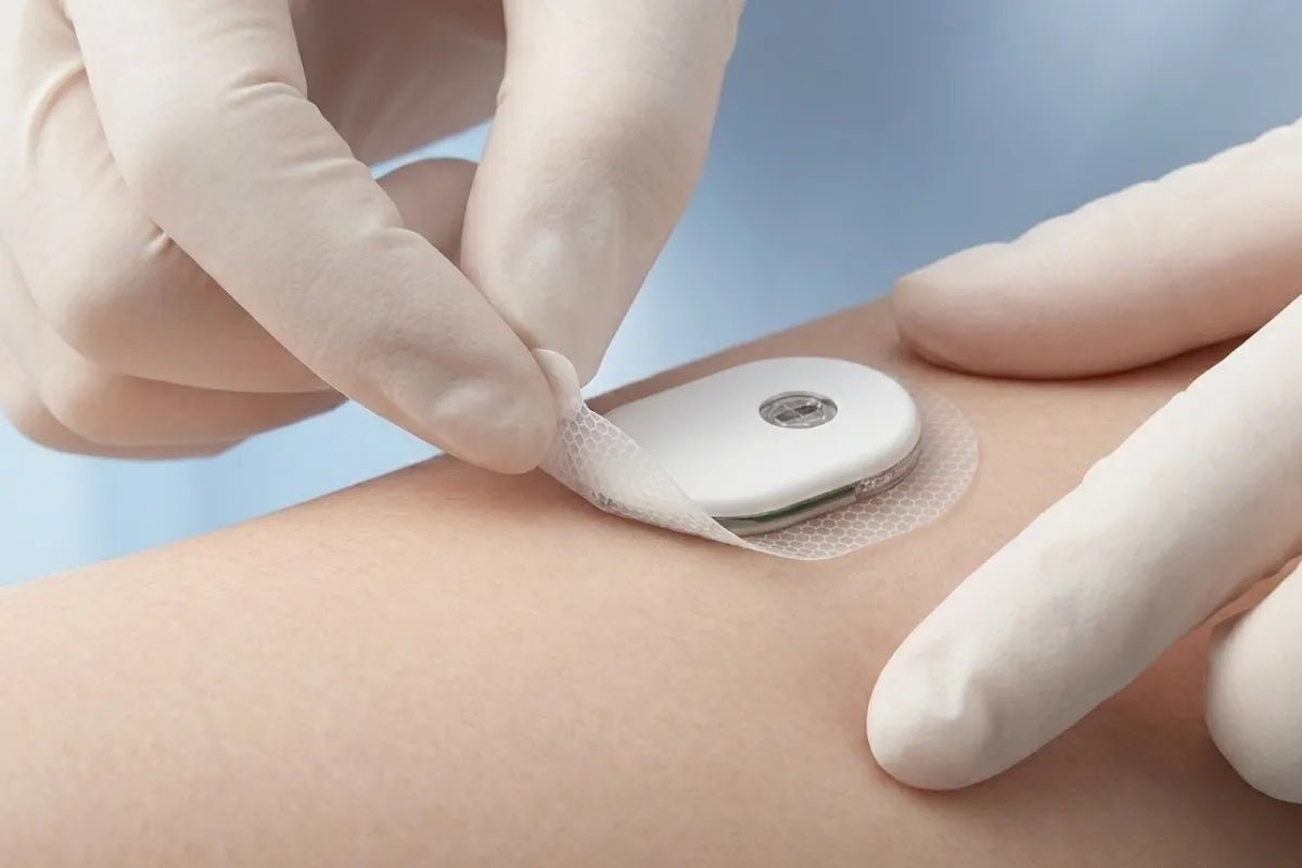 How To Remove CGM Without Pain 2026: A Complete Guide! - SIBIONICS