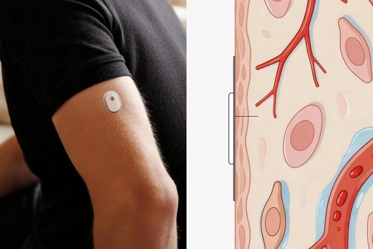 What Does A CGM Measure: More Than Blood Sugar? - SIBIONICS