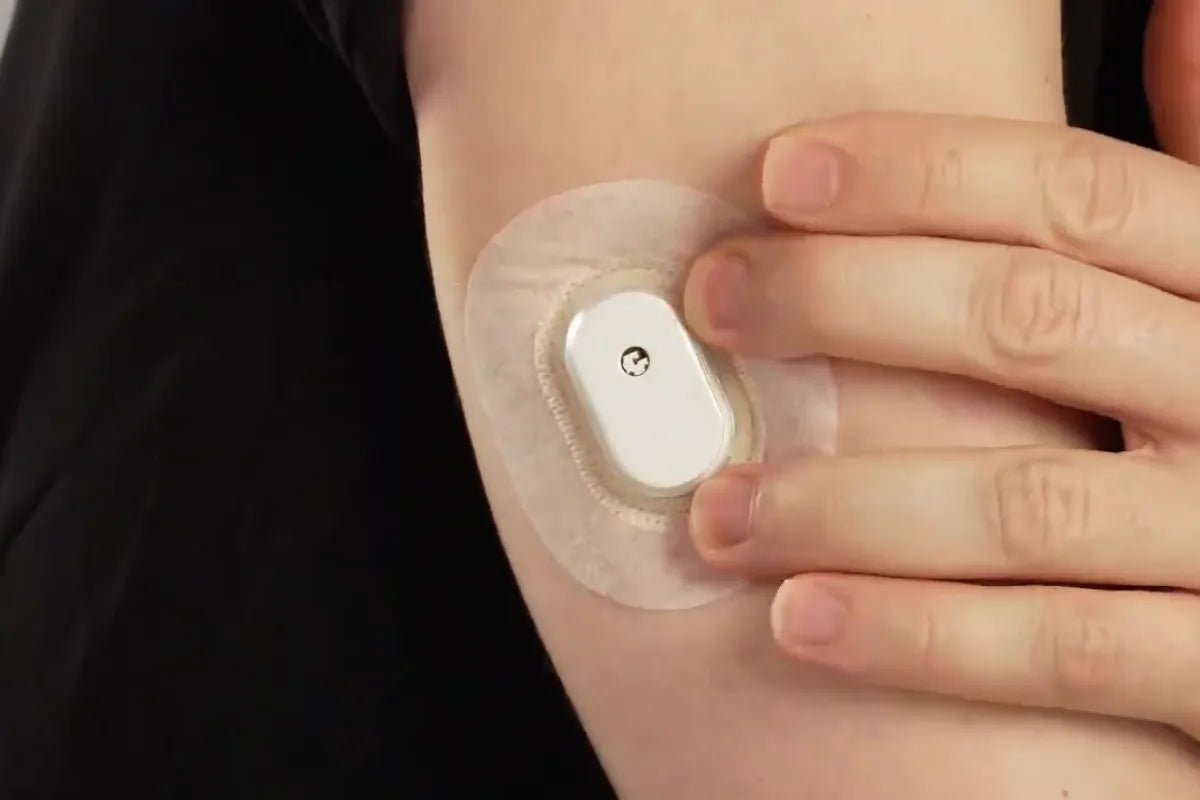 What Is A CGM Patch: Everything About CGM Overpatches! - SIBIONICS