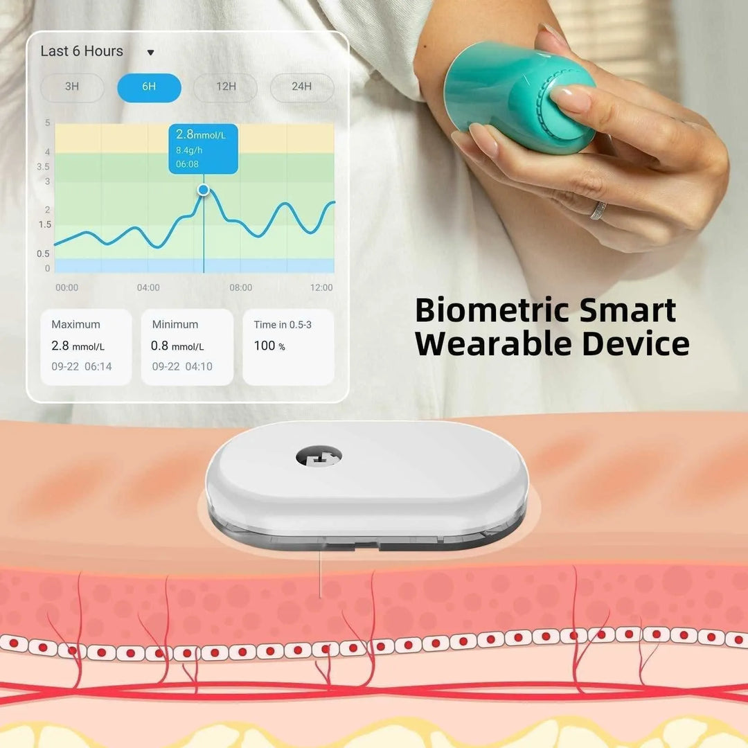 SiBio KS1 Continuous Ketone Monitoring System (CKM) - SIBIONICS