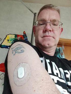A person wearing a Sibionics glucose monitor on their arm. Tattoo visible.